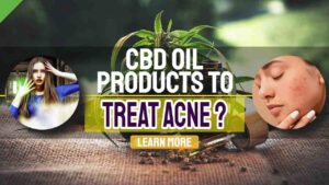 https://fybix.com/use-cbd-oil-products-to-treat-acne-top-reasons-people-use-cbd-oil/