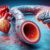 Cholesterol Blood Test: The Essential Kings Lynn Guide