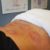 Sports Recovery Acupuncture: 6 Key Benefits to Explore